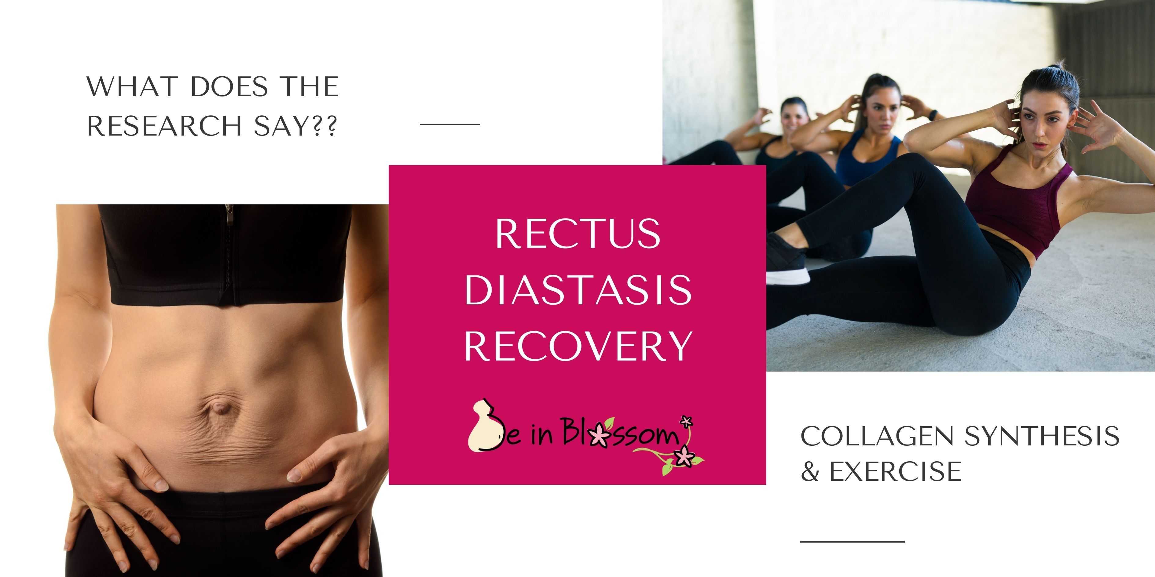 Diastasis and Collagen Synthesis